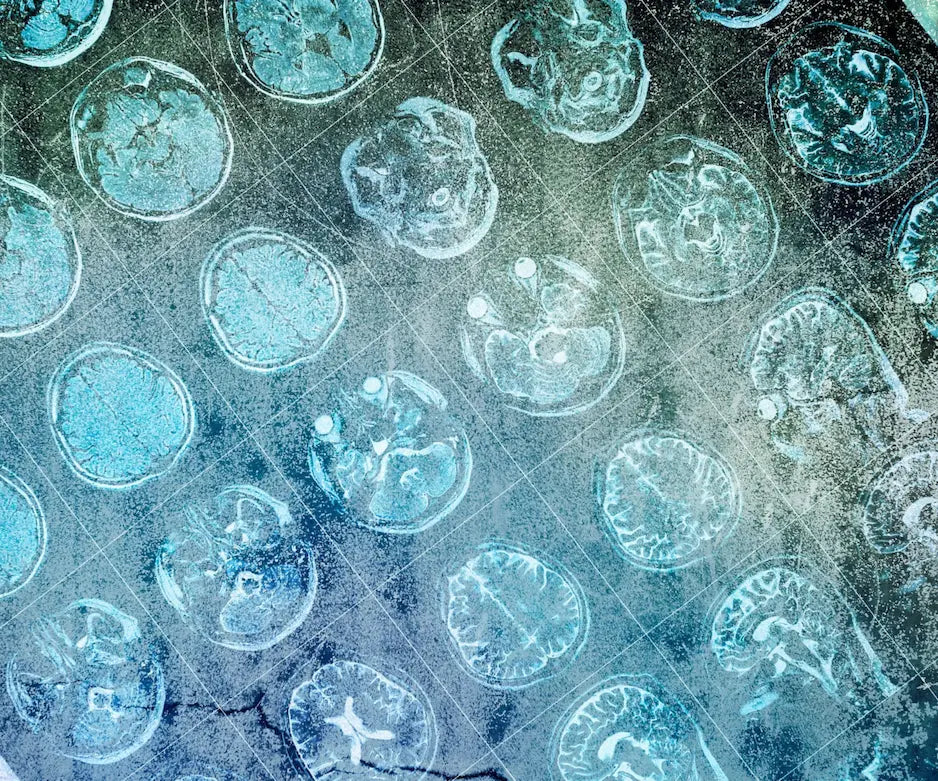 14 angeblich harmlose Alltagsgewohnheiten, die dein  Gehirn ruinieren – und was Du dagegen tun kannst