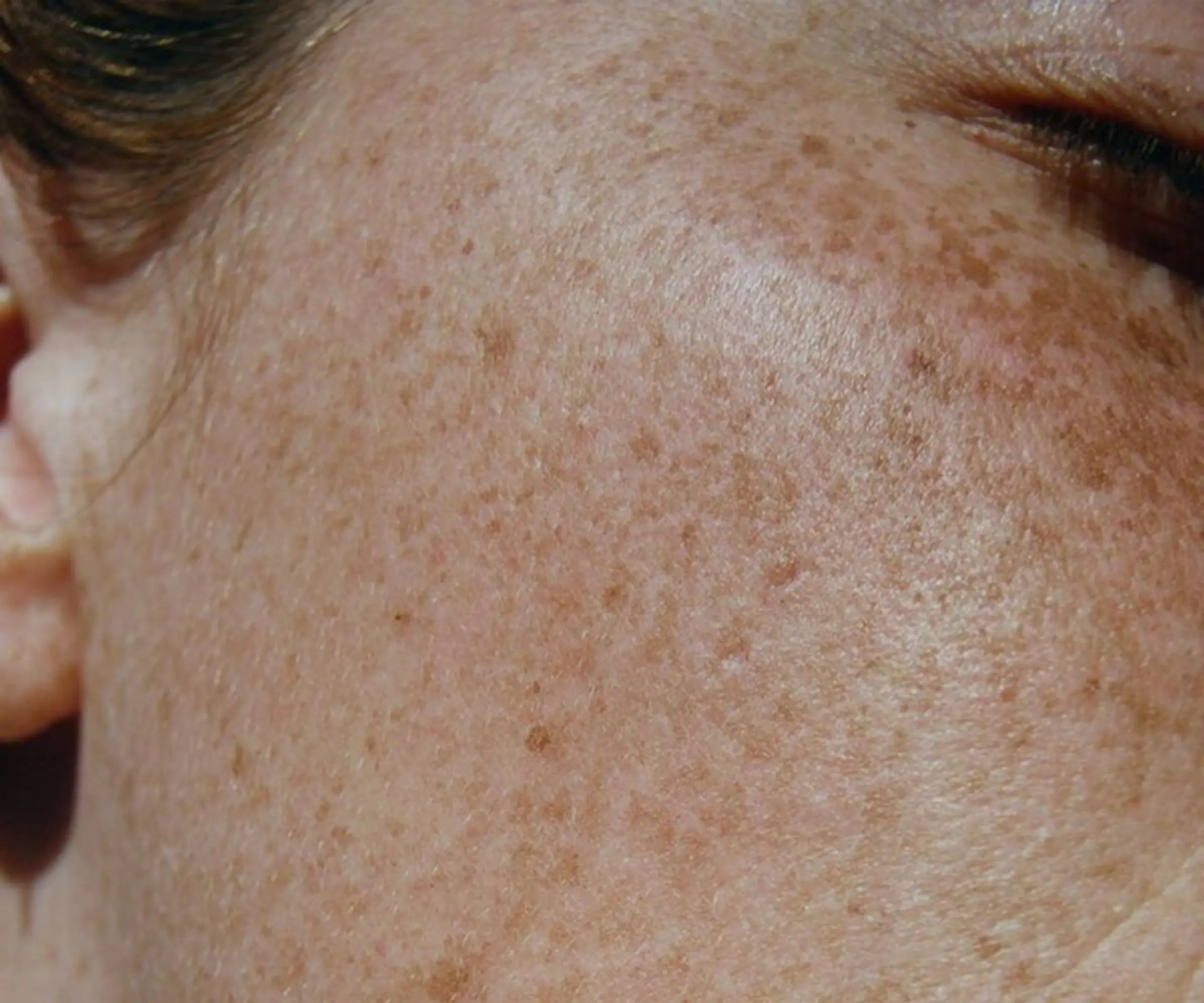 Warum trockene Winterluft dich krank macht – und was deine Haut damit zu tun hat